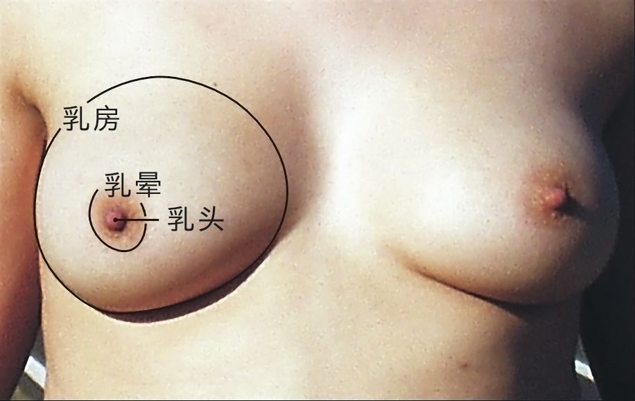 图 5，乳头是乳房上的突起，乳头周围有较深颜色的乳晕。