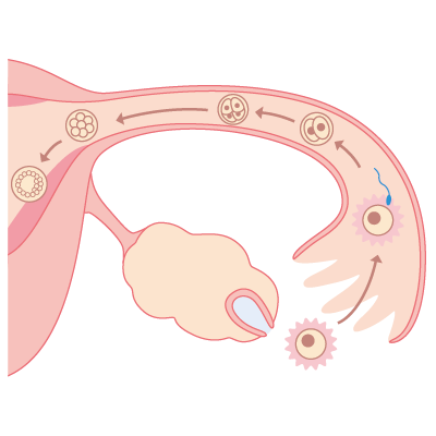 图 2,精子与卵细胞在输卵管相遇结合，并在子宫内着床